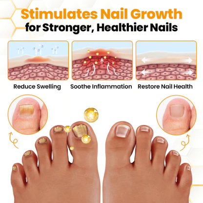 NailRenew™ | Antifungal Nail Renewal Oil