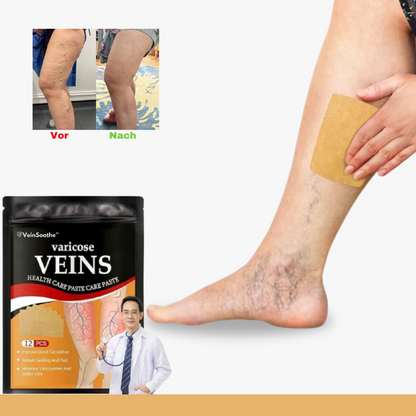 ™VeinSoothe | הכניעו את כאבי הוורידים הכרוניים!