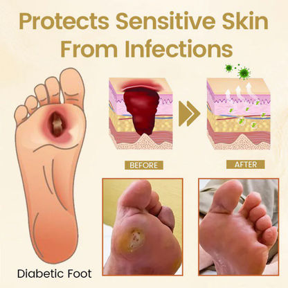 SootheStep™ | Foot Healing Spray