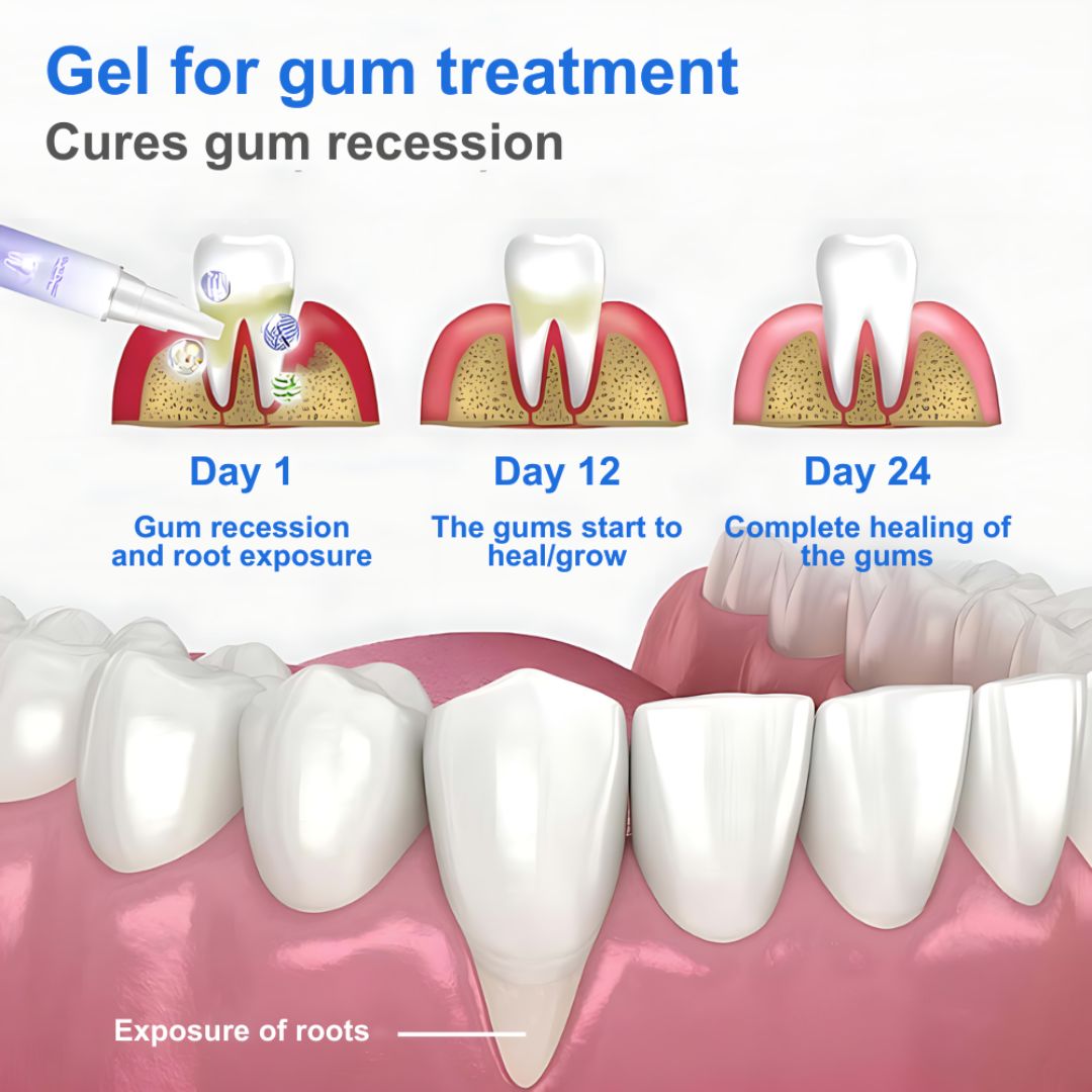 OraHeal™ | Teeth Repair Gel