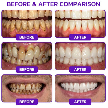 VioCore™ | Bee Venom Toothpaste