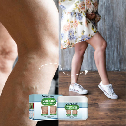 VeinEase™ | Varicose Veins Cream