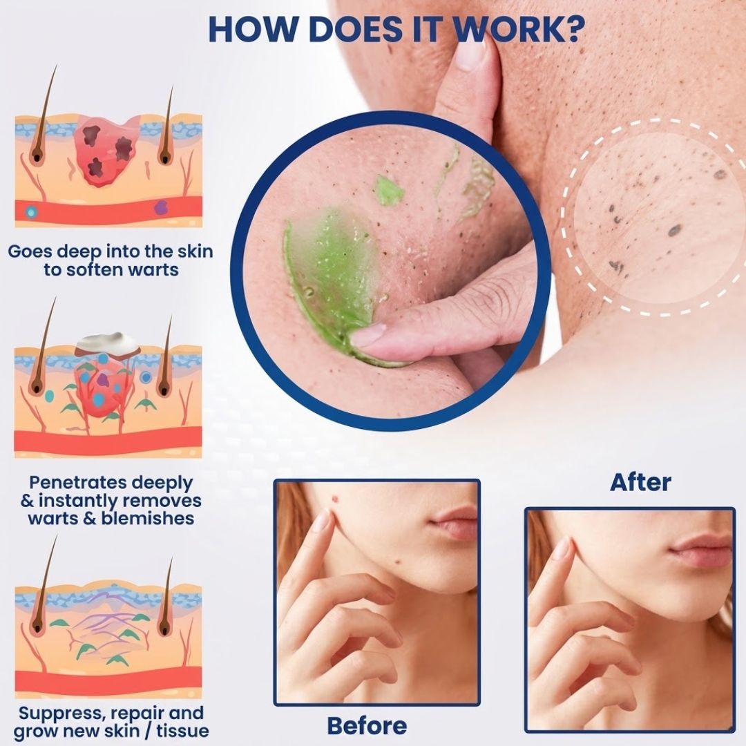 SpotVanish™ | Immediate Mole & Spot Cream