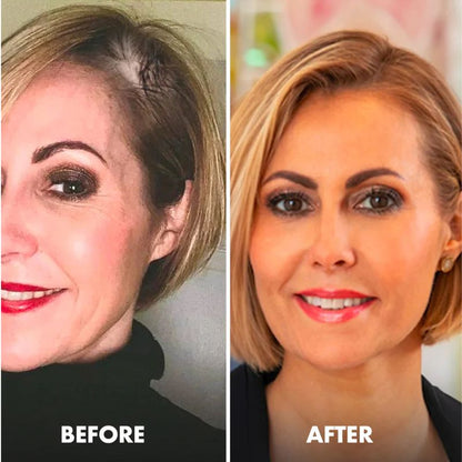 HairCure™ | Hair Strengthening Spray