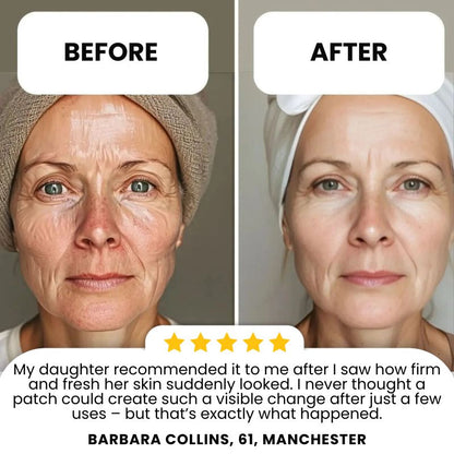 YoungSkin™ | Anti-Ageing Transdermal Patches