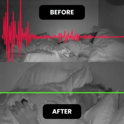 SleepEase™ | Anti-Snoring & Sleep Improvement Band