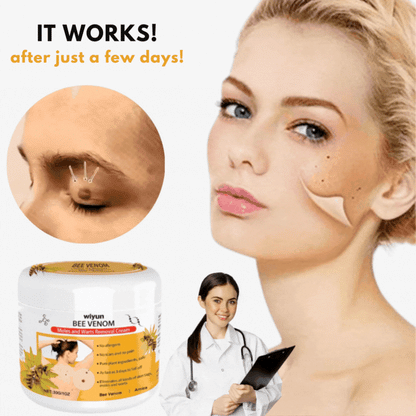 SkinClear™ | Get Rid of Annoying Skin Warts in Just 7 Days!
