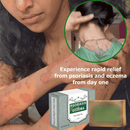 CrocDerma™ | Crocodile Oil Soap for Psoriasis and Eczema