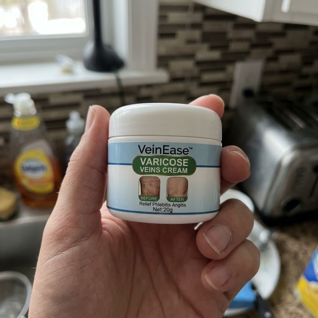 VeinEase™ | Varicose Veins Cream