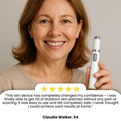 LaserPen™ | Precision Plasma Skin Corrector