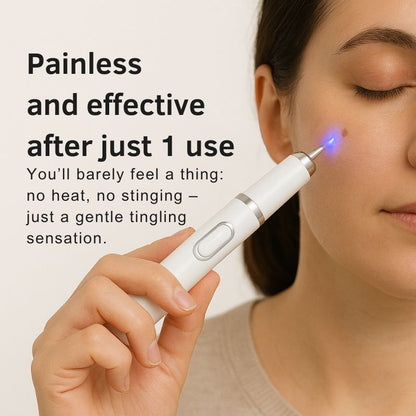 LaserPen™ | Precision Plasma Skin Corrector