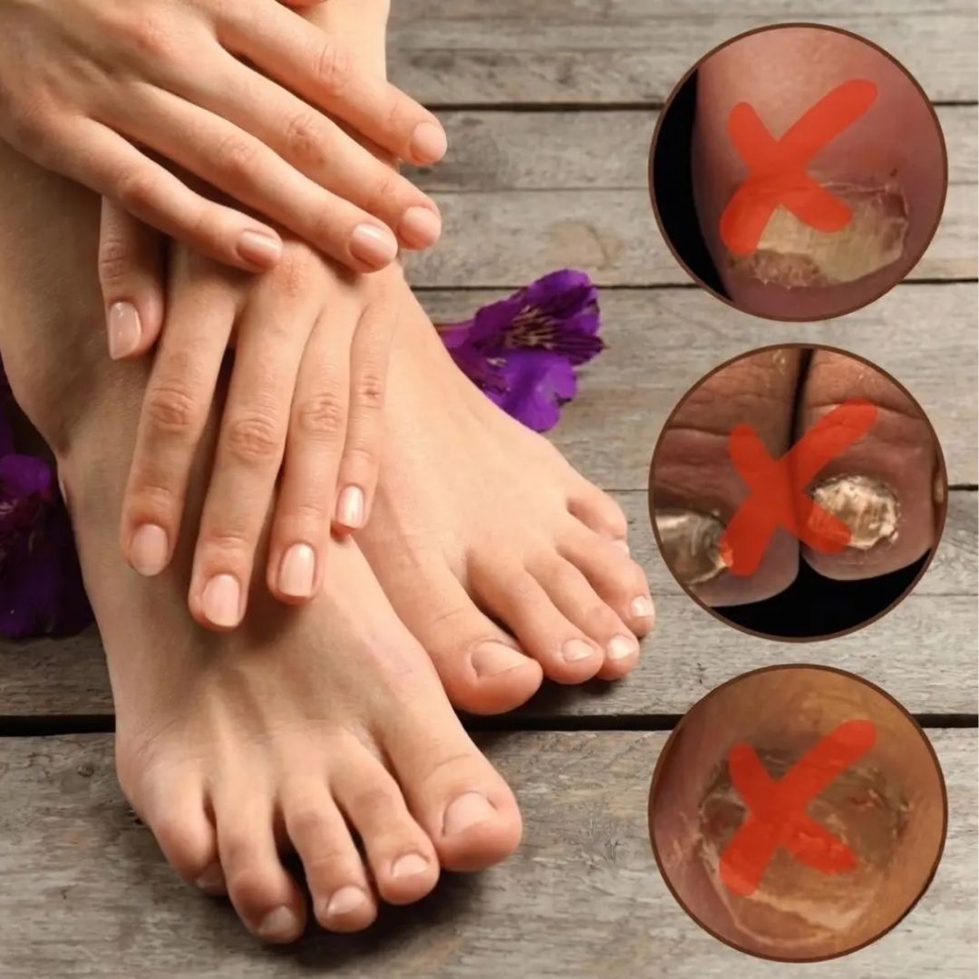 NailPure™ | Nail Fungus Solution