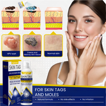 TagFree™ | Cryotherapy Skin Tag Remover Spray