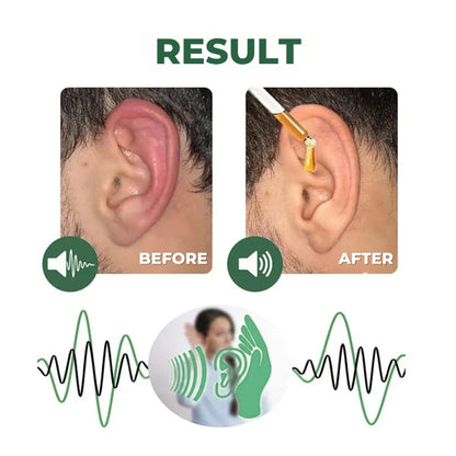 NeuroTone™ | Natural Ear Care Drops