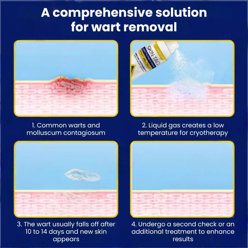 TagFree™ | Cryotherapy Skin Tag Remover Spray