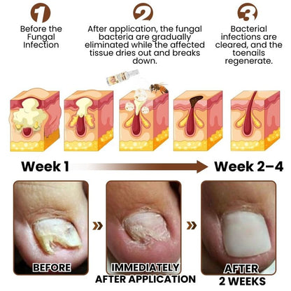 FungaBee® | Bee Venom Nail Care Spray
