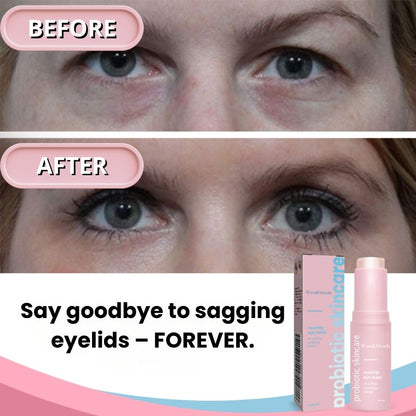 GlowBalm™ | Rosehip Eye Balm