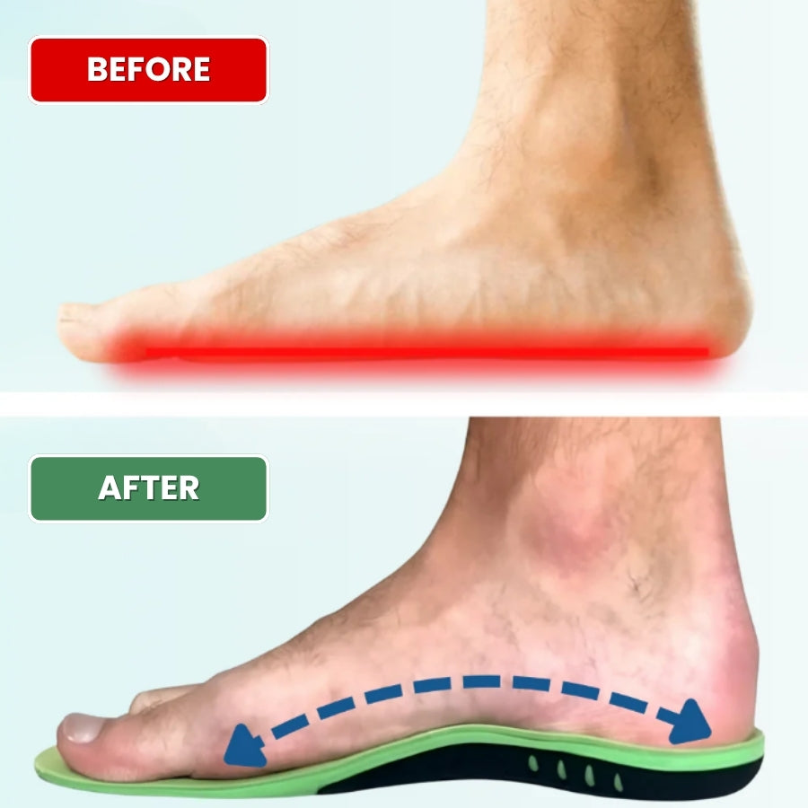 MediSole™ Insoles | Relieve Foot Pain and Improve Balance by 92% in Just 7 Days!