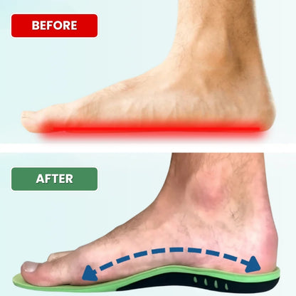 MediSole™ Insoles | Relieve Foot Pain and Improve Balance by 92% in Just 7 Days!