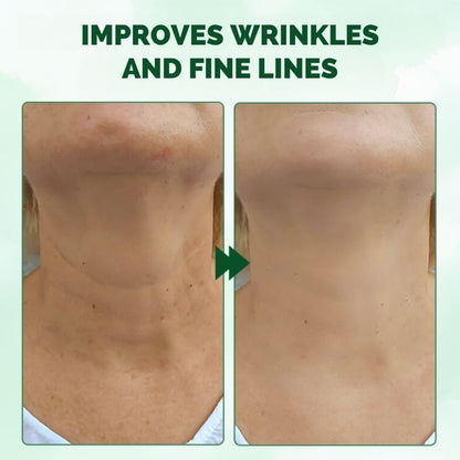 FirmingOil™ | Advanced Skin Firming Oil