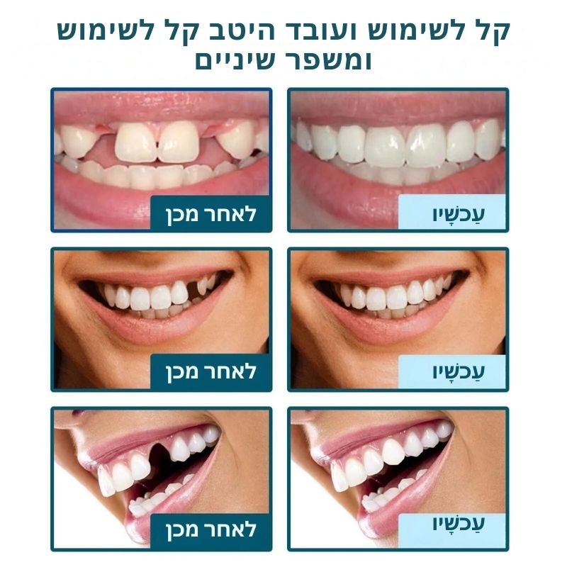 Zahnpflege™ | חייך ללא דאגות תוך שנייה אחת בלבד!