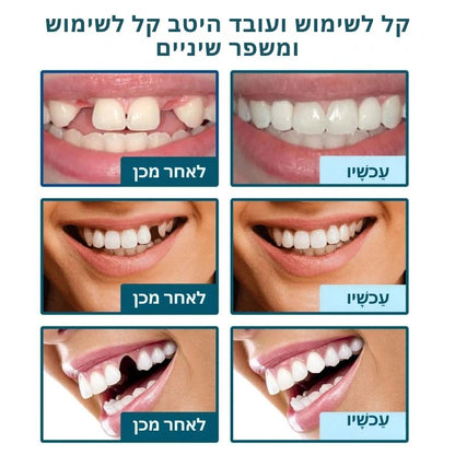 Zahnpflege™ | חייך ללא דאגות תוך שנייה אחת בלבד!