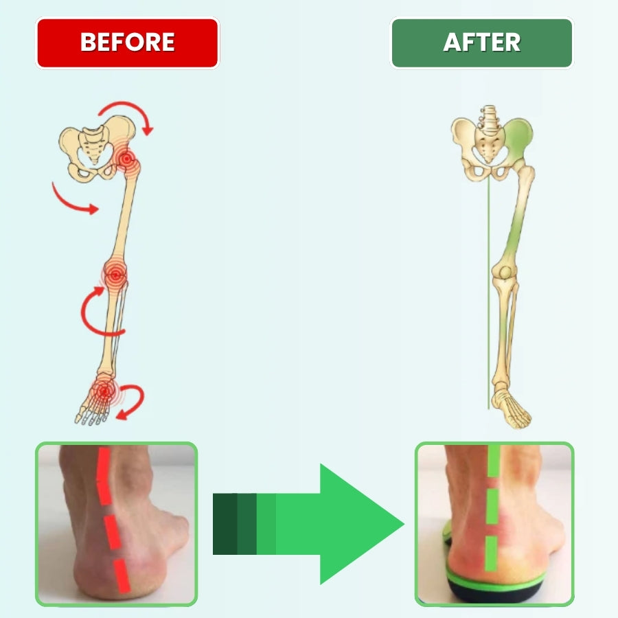 MediSole™ Insoles | Relieve Foot Pain and Improve Balance by 92% in Just 7 Days!