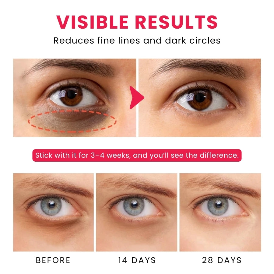 EyeLiss™ | Retinol Eye Stick Cream