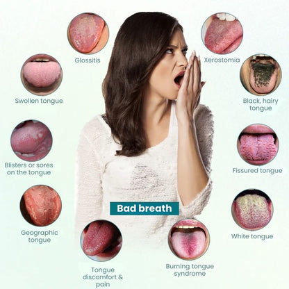 FreshTongue™ | Tongue Repair Spray