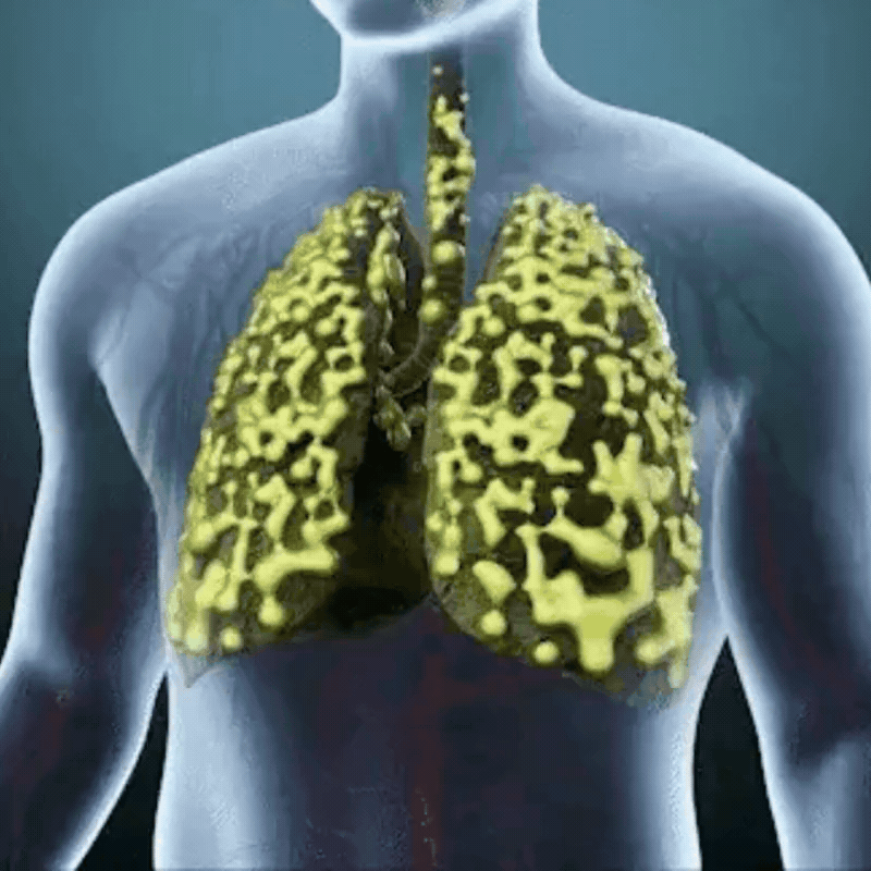 LungClean™ Inhaler Pen | Breathe deeper and clear your lungs in just 7 days