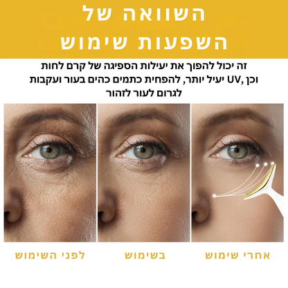 YouthGlow™ | השיבי את המוצקות הצעירה שלך תוך שבוע!