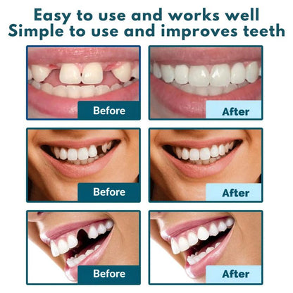 DentalCare™ | Smile without worries in just one second!