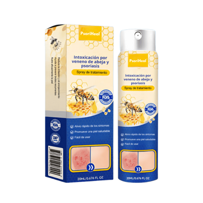 PsoriHeal™ | Psoriasis and Eczema Treatment Spray