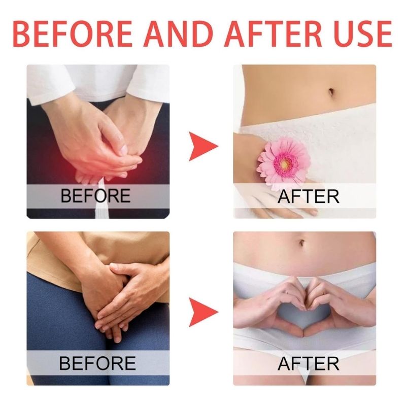 FemiDerm™ | Private Itching Relief Cream for Women