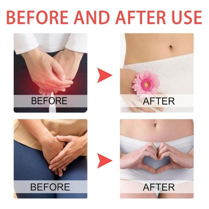FemiDerm™ | Private Itching Relief Cream for Women