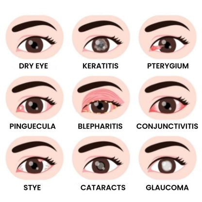 OpticRevive™ | Vision-Enhancing Eye Drops