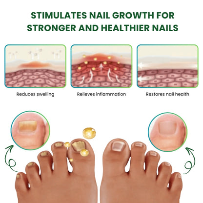 NailHeal™ | Herbal Nail Renewal Spray