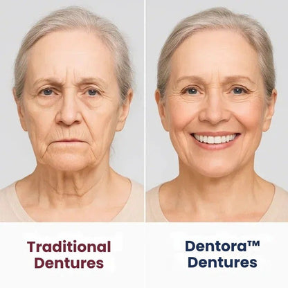 Dentora™ | Instant Denture