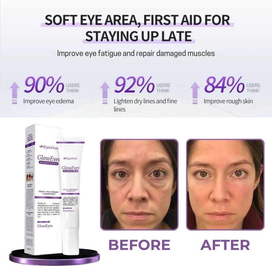 EyeVive™ | Collagen Eye Cream