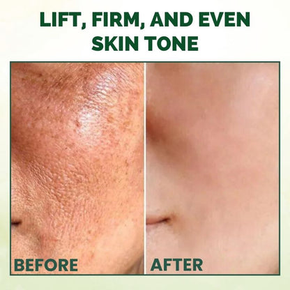 NouriLift™ | Beef Tallow & Manuka Honey Balm for Skin Firming