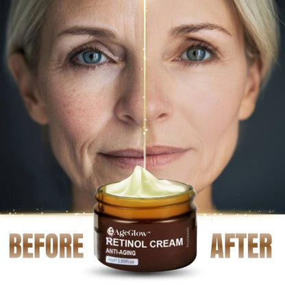 AgeGlow™ |  Anti-Aging Retinol Cream