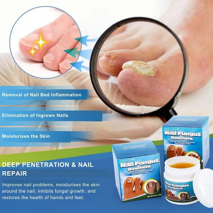 ClearNail™ | Fast Antifungal Ointment