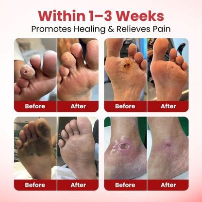 VitaGluco™ | Diabetic Skin Repair Cream