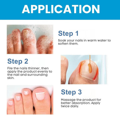 ClearNail™ | Fast Antifungal Ointment