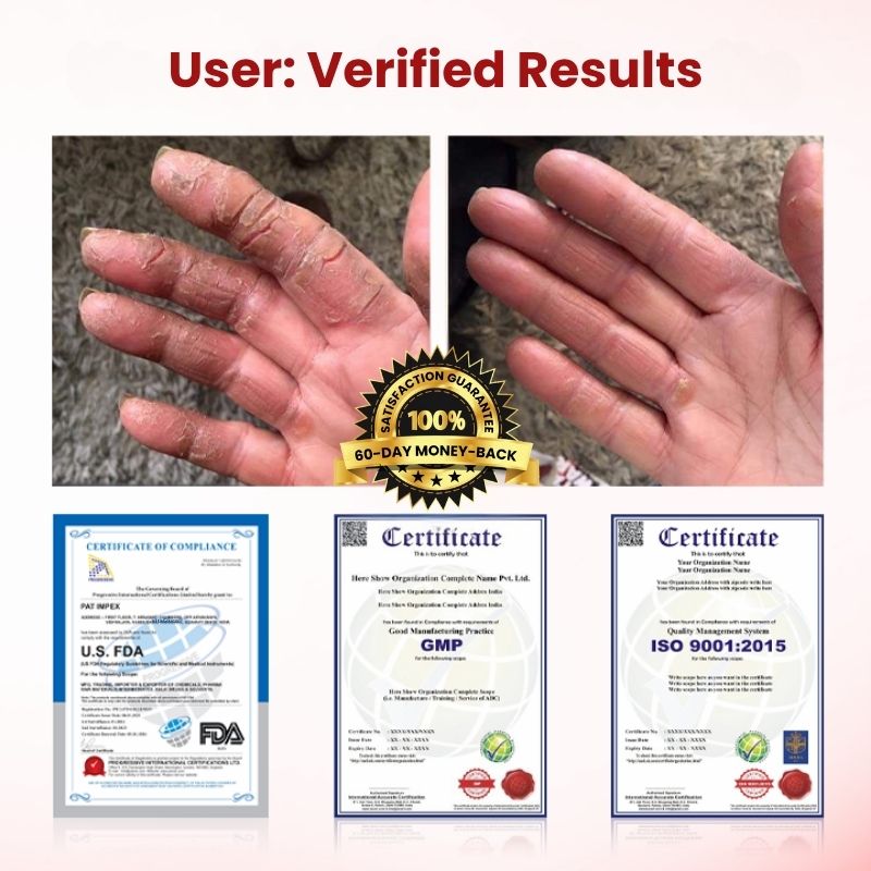 VitaGluco™ | Diabetic Skin Repair Cream