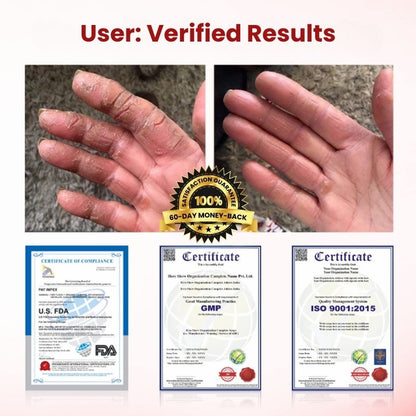 VitaGluco™ | Diabetic Skin Repair Cream
