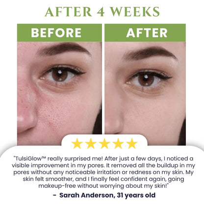 TulsiGlow™ | Holy Basil Bubble Mask