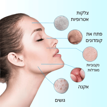 RadiantGlow | סרום לתיקון איזון
