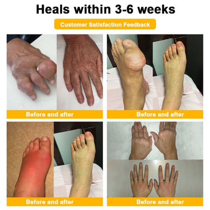 ArthroFlex™ | Botulinum & Bee Verm for Bone Healing