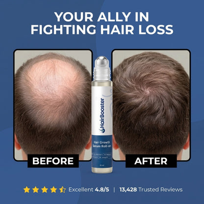 HairBooster™ | Hair Growth Roll on Serum